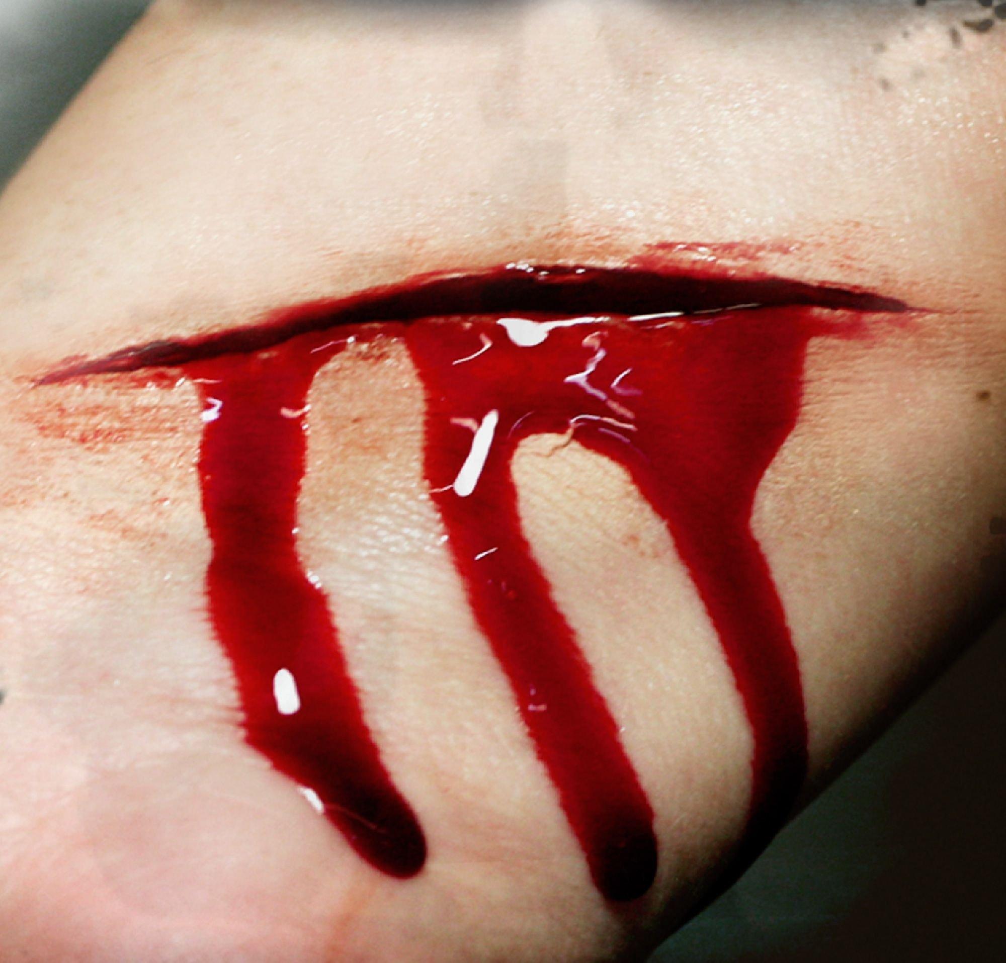 Slash Prosthetics- Tinsley Transfers