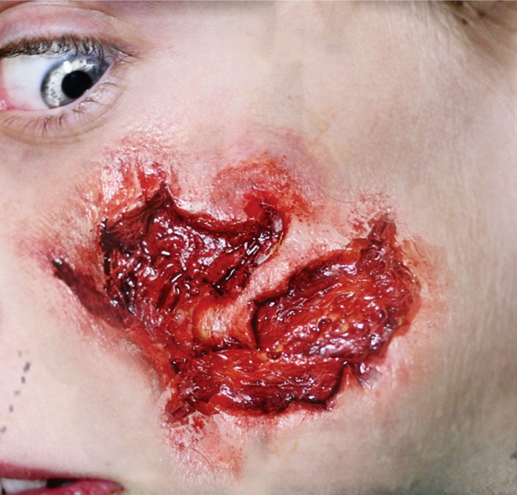 Small Gouge Wound Prosthetic- Tinsley Transfers